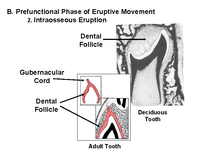 B. Prefunctional Phase of Eruptive Movement 2. Intraosseous Eruption Dental Follicle Gubernacular Cord Dental