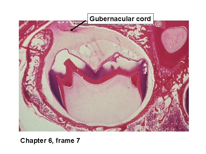 Gubernacular cord Chapter 6, frame 7 