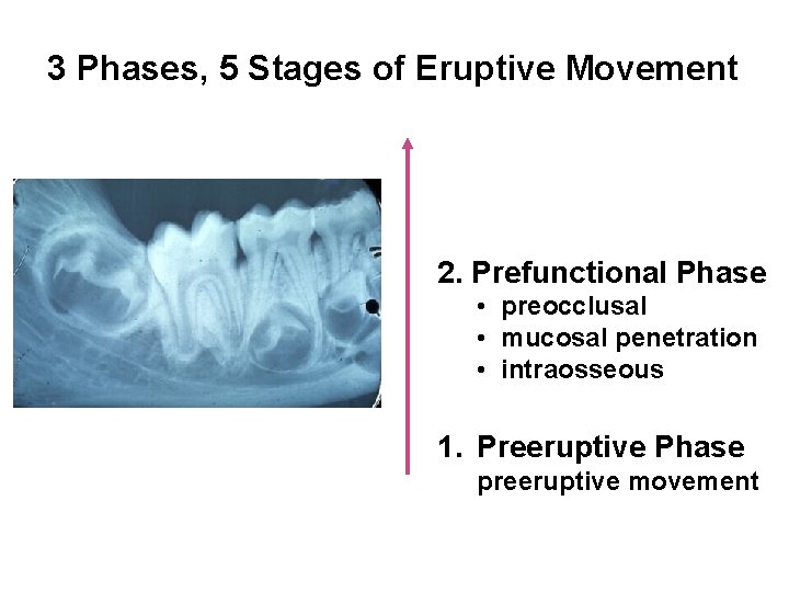 3 Phases, 5 Stages of Eruptive Movement 2. Prefunctional Phase • preocclusal • mucosal