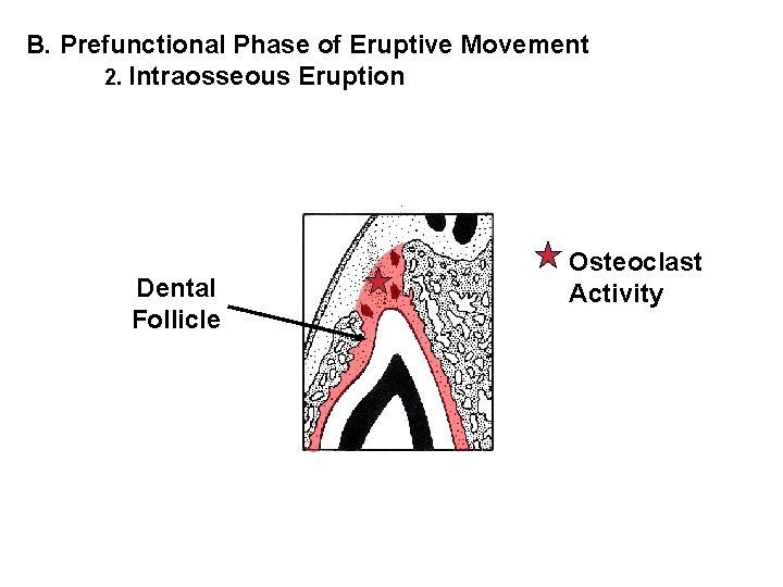 B. Prefunctional Phase of Eruptive Movement 2. Intraosseous Eruption Dental Follicle Osteoclast Activity 
