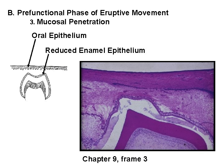 B. Prefunctional Phase of Eruptive Movement 3. Mucosal Penetration Oral Epithelium Reduced Enamel Epithelium