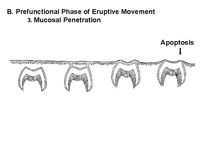 B. Prefunctional Phase of Eruptive Movement 3. Mucosal Penetration Apoptosis 