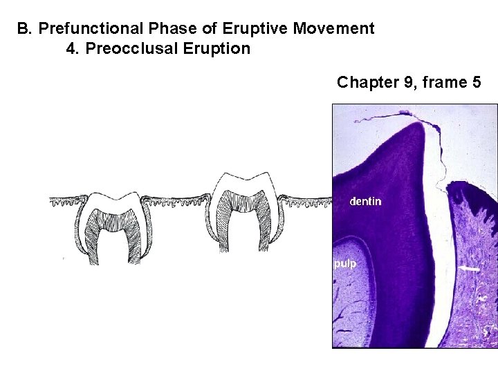 B. Prefunctional Phase of Eruptive Movement 4. Preocclusal Eruption Chapter 9, frame 5 