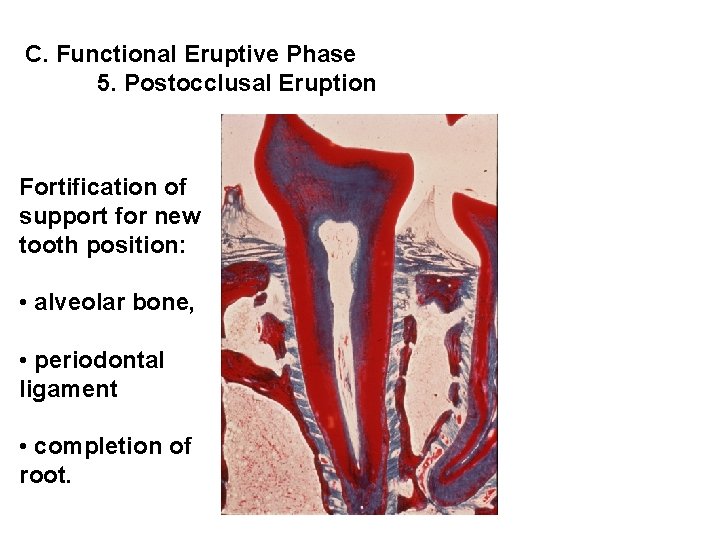 C. Functional Eruptive Phase 5. Postocclusal Eruption Fortification of support for new tooth position: