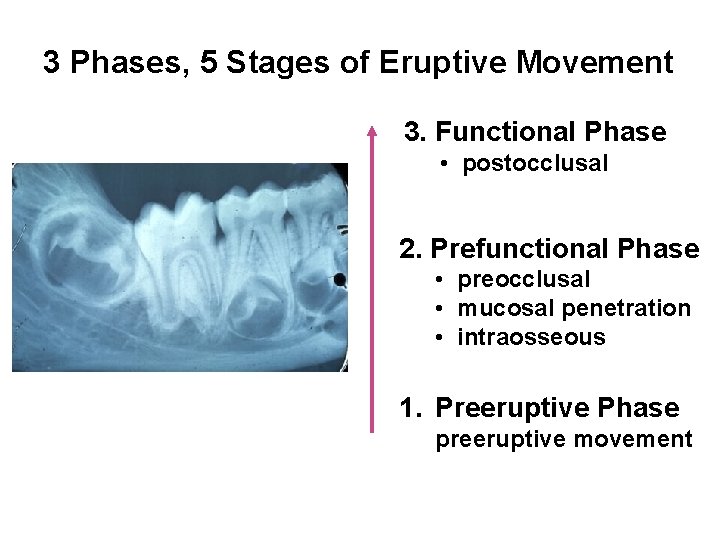 3 Phases, 5 Stages of Eruptive Movement 3. Functional Phase • postocclusal 2. Prefunctional