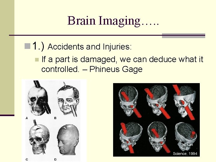 Brain Imaging…. . n 1. ) Accidents and Injuries: n If a part is