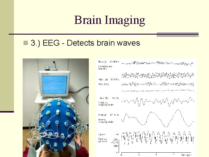 Brain Imaging n 3. ) EEG - Detects brain waves 