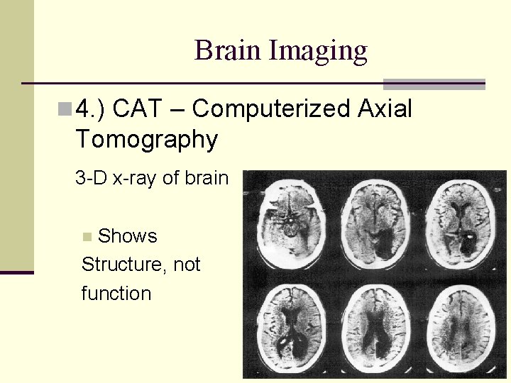 Brain Imaging n 4. ) CAT – Computerized Axial Tomography 3 -D x-ray of