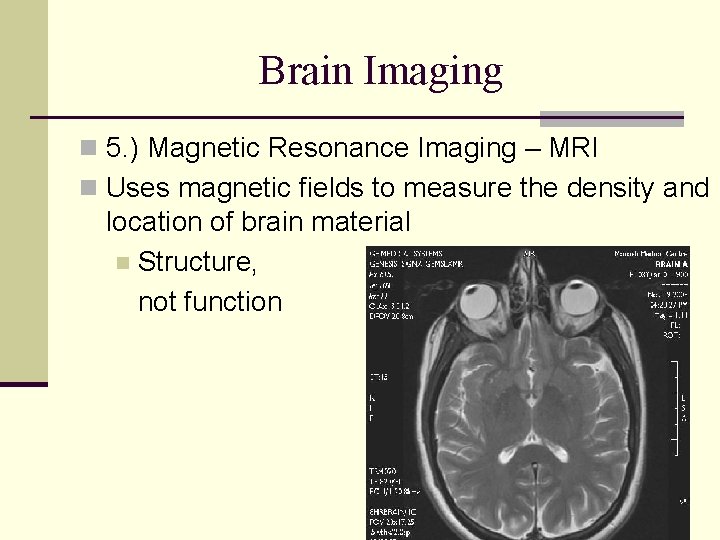 Brain Imaging n 5. ) Magnetic Resonance Imaging – MRI n Uses magnetic fields