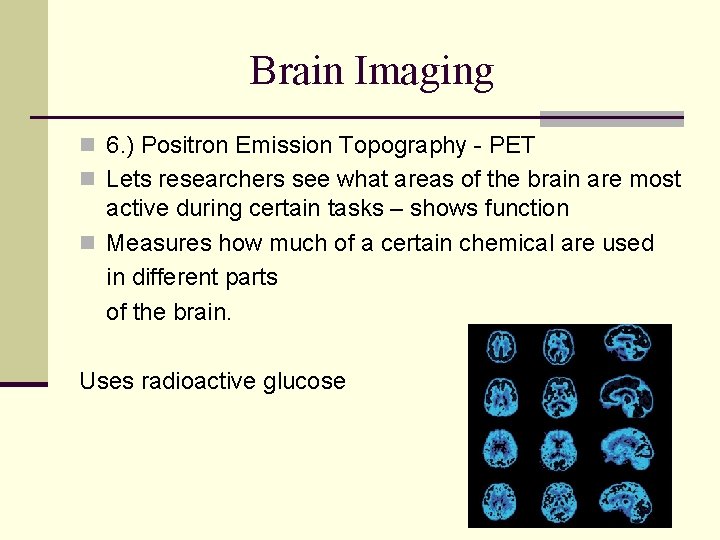 Brain Imaging n 6. ) Positron Emission Topography - PET n Lets researchers see