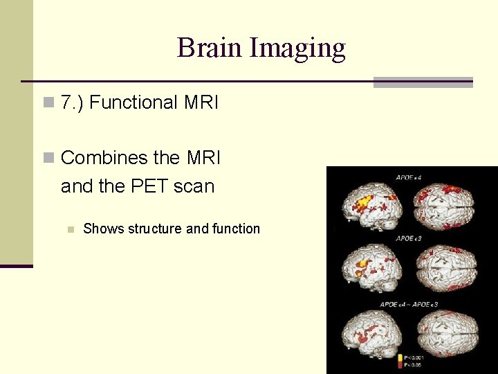 Brain Imaging n 7. ) Functional MRI n Combines the MRI and the PET