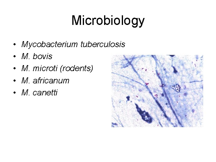 Microbiology • • • Mycobacterium tuberculosis M. bovis M. microti (rodents) M. africanum M.
