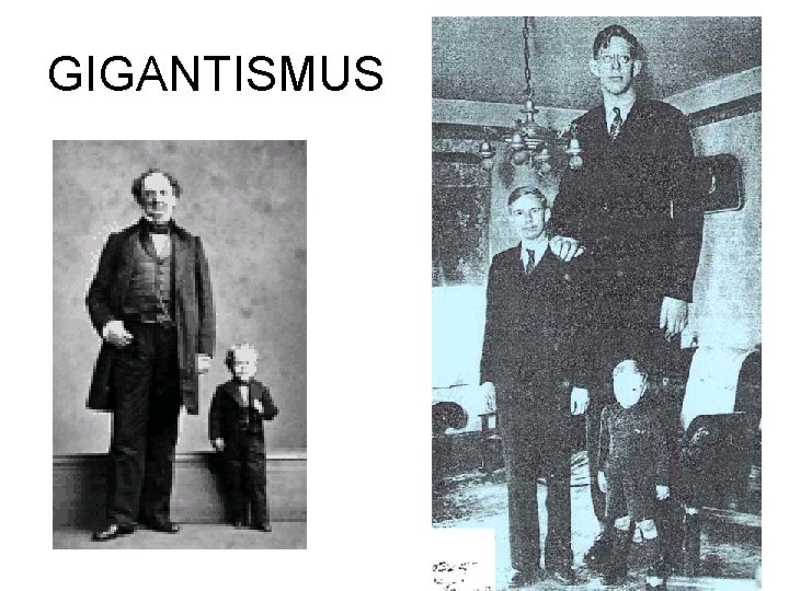 GIGANTISMUS 