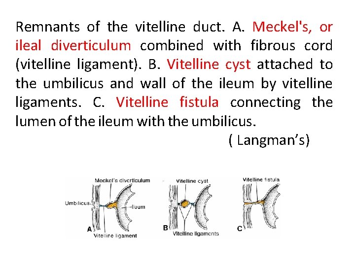 Remnants of the vitelline duct. A. Meckel's, or ileal diverticulum combined with fibrous cord