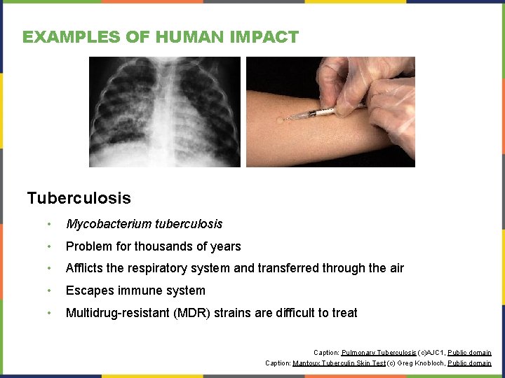 EXAMPLES OF HUMAN IMPACT Tuberculosis • Mycobacterium tuberculosis • Problem for thousands of years EXAMPLES OF HUMAN IMPACT Tuberculosis • Mycobacterium tuberculosis • Problem for thousands of years