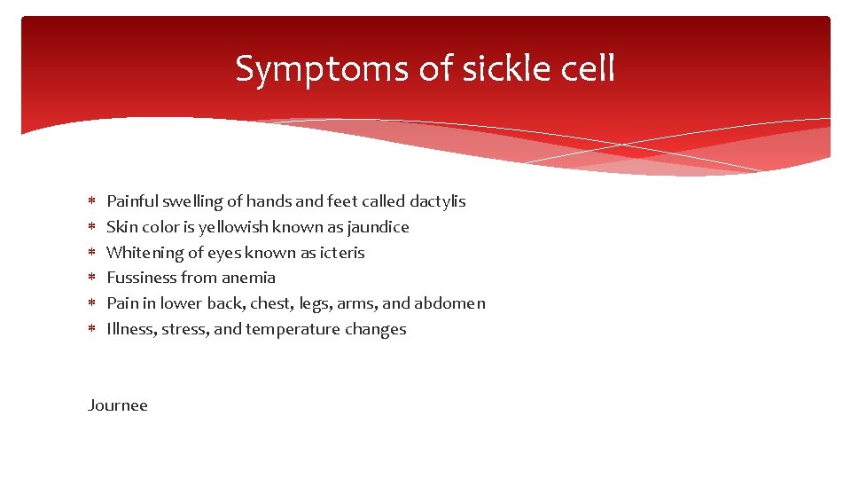 Symptoms of sickle cell Painful swelling of hands and feet called dactylis Skin color