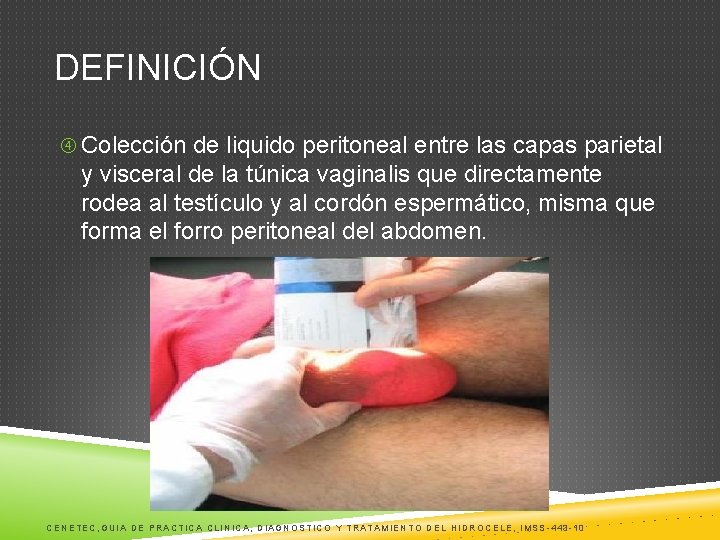 DEFINICIÓN Colección de liquido peritoneal entre las capas parietal y visceral de la túnica