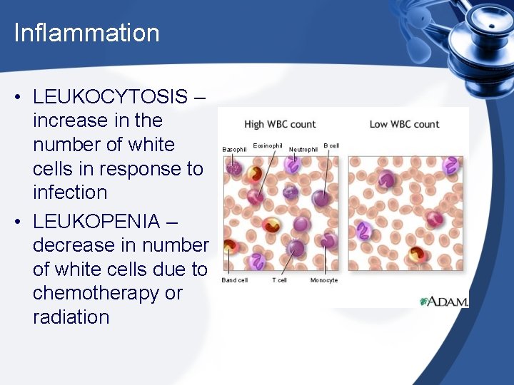 Inflammation • LEUKOCYTOSIS – increase in the number of white cells in response to