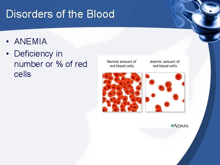 Disorders of the Blood • ANEMIA • Deficiency in number or % of red