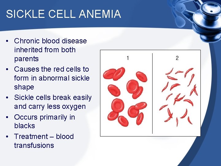 SICKLE CELL ANEMIA • Chronic blood disease inherited from both parents • Causes the