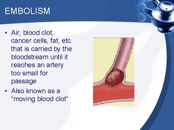 EMBOLISM • Air, blood clot, cancer cells, fat, etc. that is carried by the