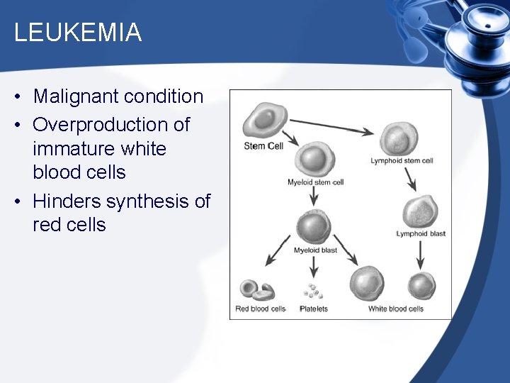 LEUKEMIA • Malignant condition • Overproduction of immature white blood cells • Hinders synthesis