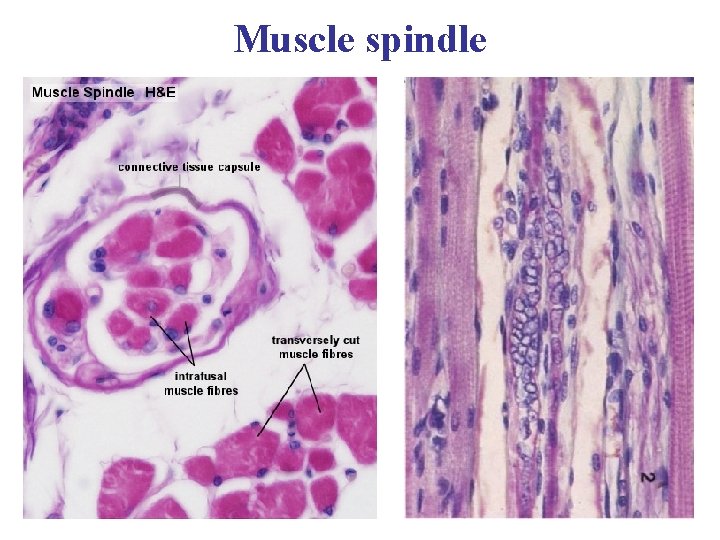 Muscle spindle 