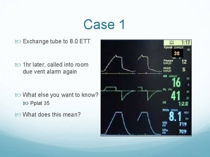 Case 1 Exchange tube to 8. 0 ETT 38 1 hr later, called into