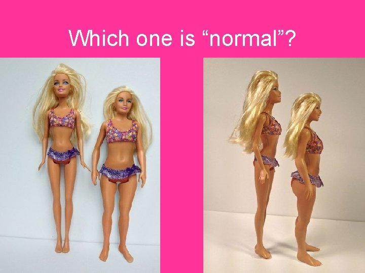 Which one is “normal”? 