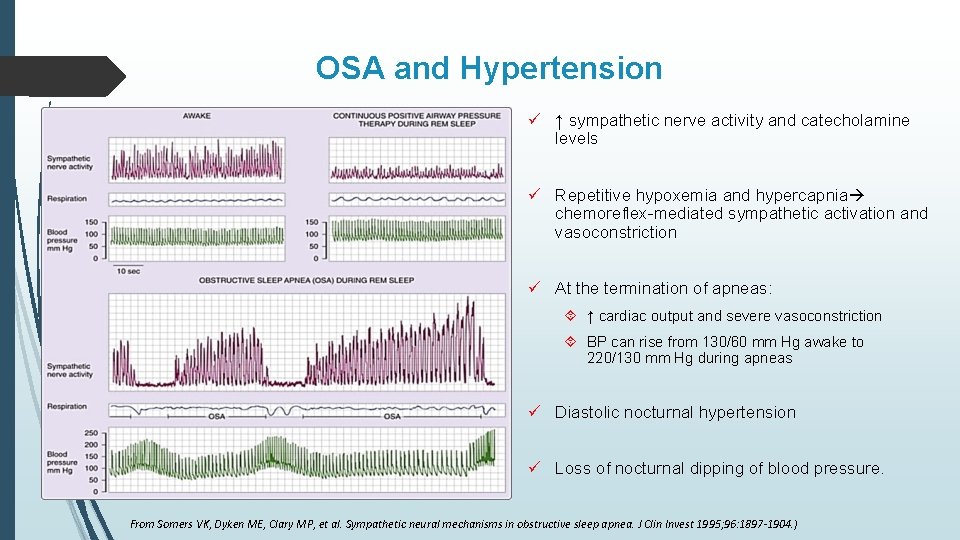 OSA and Hypertension ü ↑ sympathetic nerve activity and catecholamine levels ü Repetitive hypoxemia