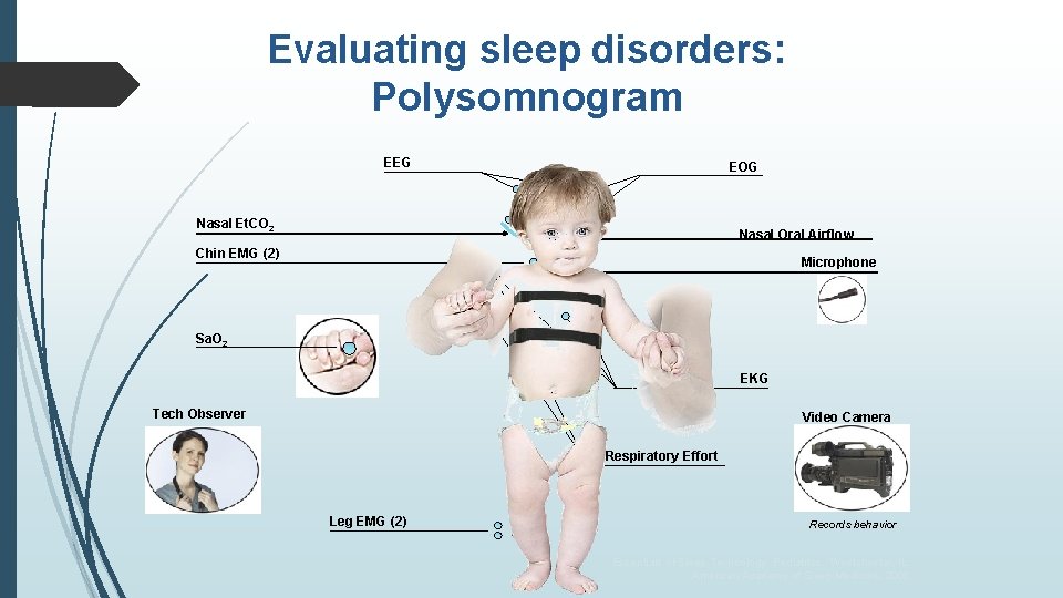 Evaluating sleep disorders: Polysomnogram EEG EOG Nasal Et. CO 2 Nasal Oral Airflow Chin