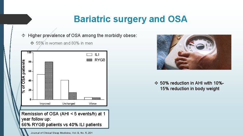 Bariatric surgery and OSA Higher prevalence of OSA among the morbidly obese: 55% in