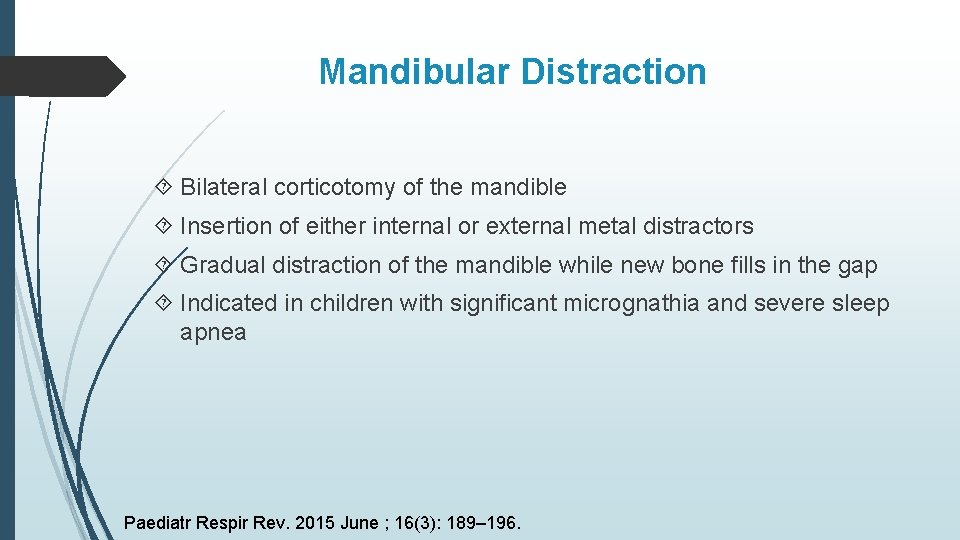 Mandibular Distraction Bilateral corticotomy of the mandible Insertion of either internal or external metal