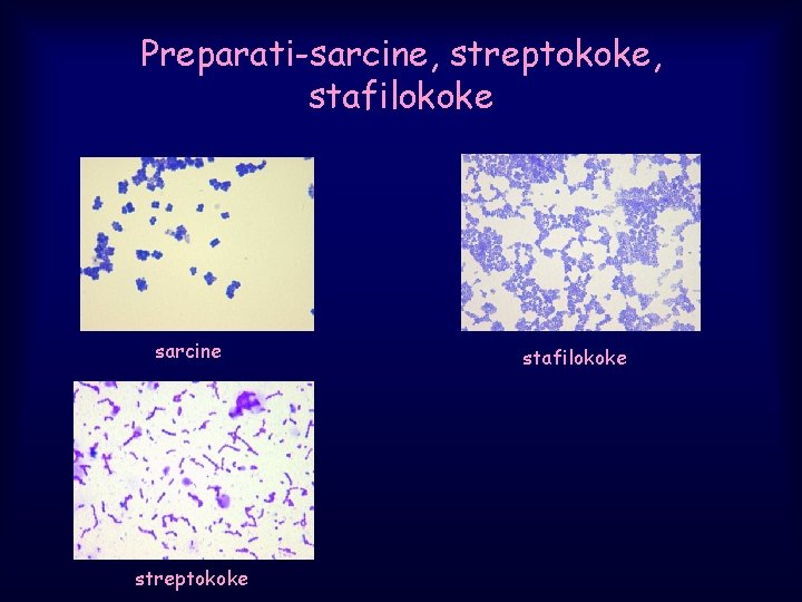 Preparati-sarcine, streptokoke, stafilokoke sarcine streptokoke stafilokoke 