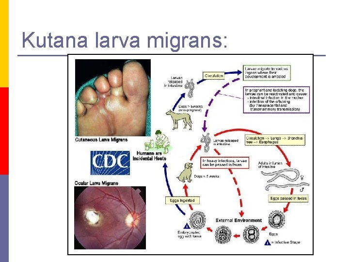 Kutana larva migrans: 