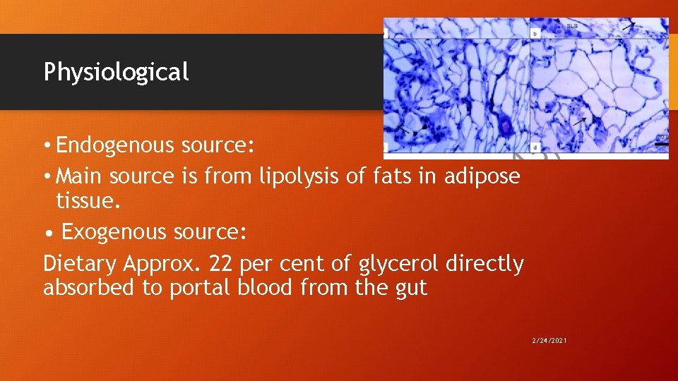 Physiological 25 • Endogenous source: • Main source is from lipolysis of fats in