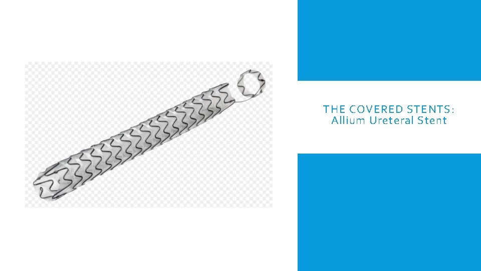 THE COVERED STENTS: Allium Ureteral Stent 