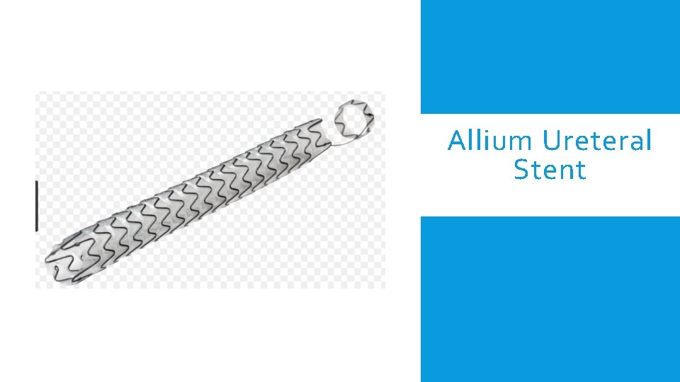 Allium Ureteral Stent 