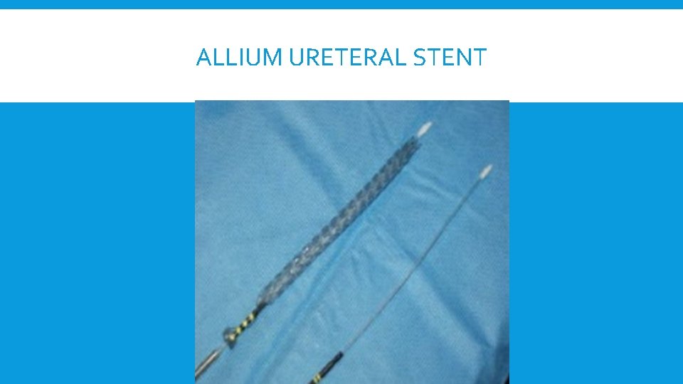 ALLIUM URETERAL STENT 