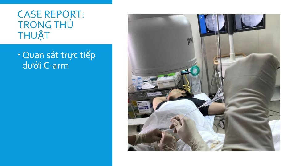 CASE REPORT: TRONG THỦ THUẬT Quan sát trực tiếp dưới C-arm 
