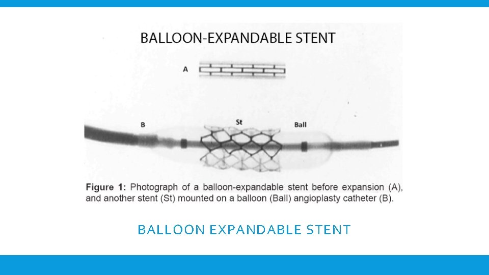 BALLOON EXPANDABLE STENT 