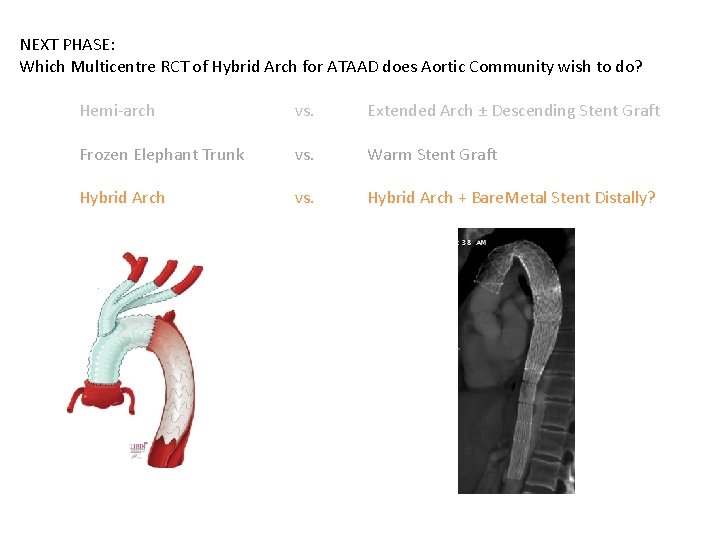 NEXT PHASE: Which Multicentre RCT of Hybrid Arch for ATAAD does Aortic Community wish