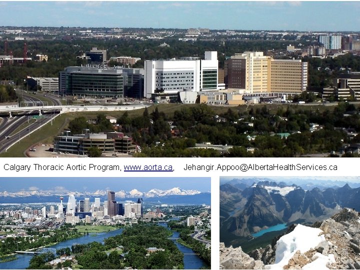 Calgary Thoracic Aortic Program, www. aorta. ca, Jehangir. Appoo@Alberta. Health. Services. ca 