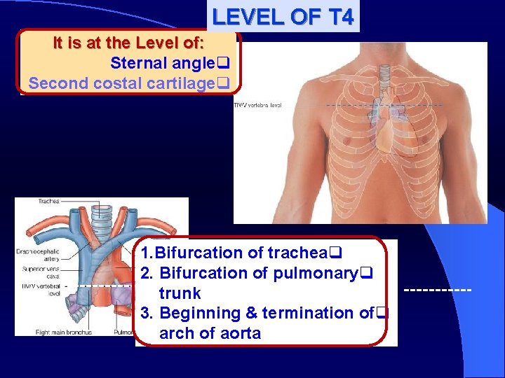 LEVEL OF T 4 It is at the Level of: Sternal angleq Second costal