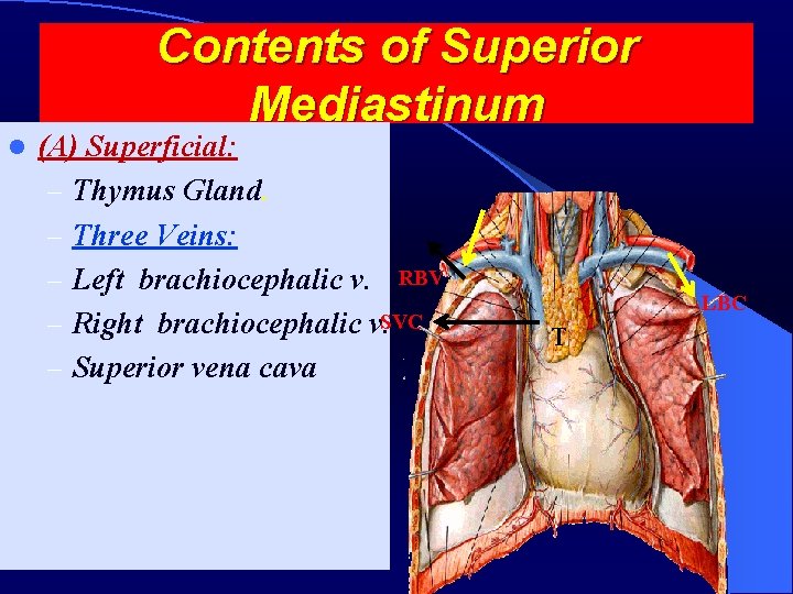 Contents of Superior Mediastinum l (A) Superficial: – Thymus Gland. – Three Veins: –