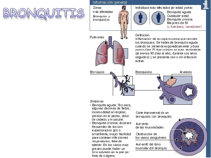 BRONQUITIS 