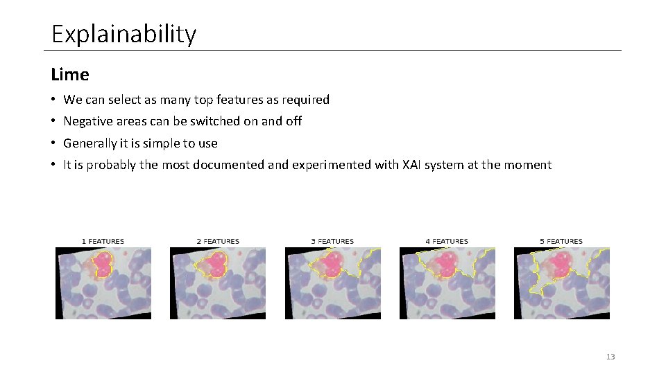 Explainability Lime • We can select as many top features as required • Negative Explainability Lime • We can select as many top features as required • Negative
