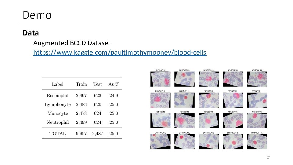 Demo Data Augmented BCCD Dataset https: //www. kaggle. com/paultimothymooney/blood-cells 24 Demo Data Augmented BCCD Dataset https: //www. kaggle. com/paultimothymooney/blood-cells 24