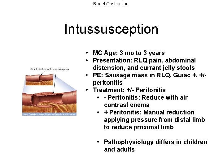 Bowel Obstruction Intussusception • MC Age: 3 mo to 3 years • Presentation: RLQ