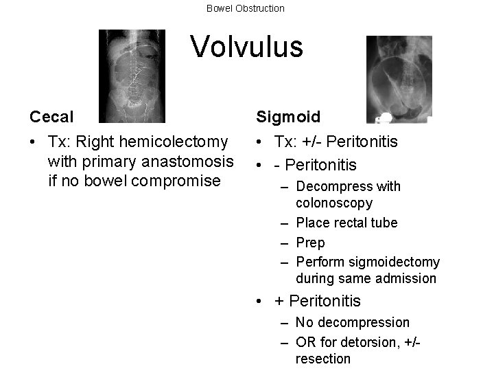 Bowel Obstruction Volvulus Cecal • Tx: Right hemicolectomy with primary anastomosis if no bowel